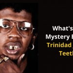 Trinidad James Teeth