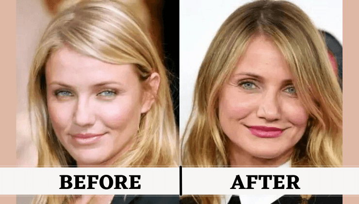 Cameron Diaz Before After