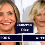 Cameron Diaz Plastic Surgery | Her Looks Before And After