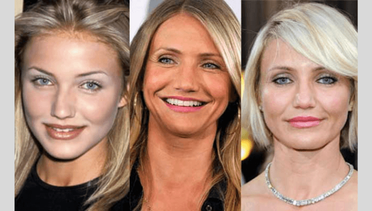 What Is Rhinoplasty And Which Plastic Surgery Did Cameron Diaz Have?